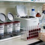 SPE Cleanup for LC-MS Analysis of Blood Samples
