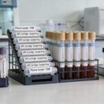 SPE Sample Preparation for Therapeutic Drug Monitoring