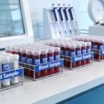 Preparing Blood Samples for LC-MS Toxicology Screening Using SPE